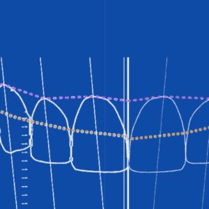 The Occlusal Blueprint — Hands On Course